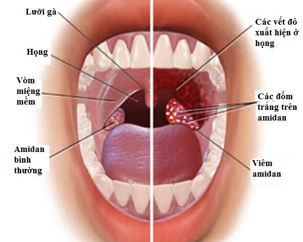 VN86 Game